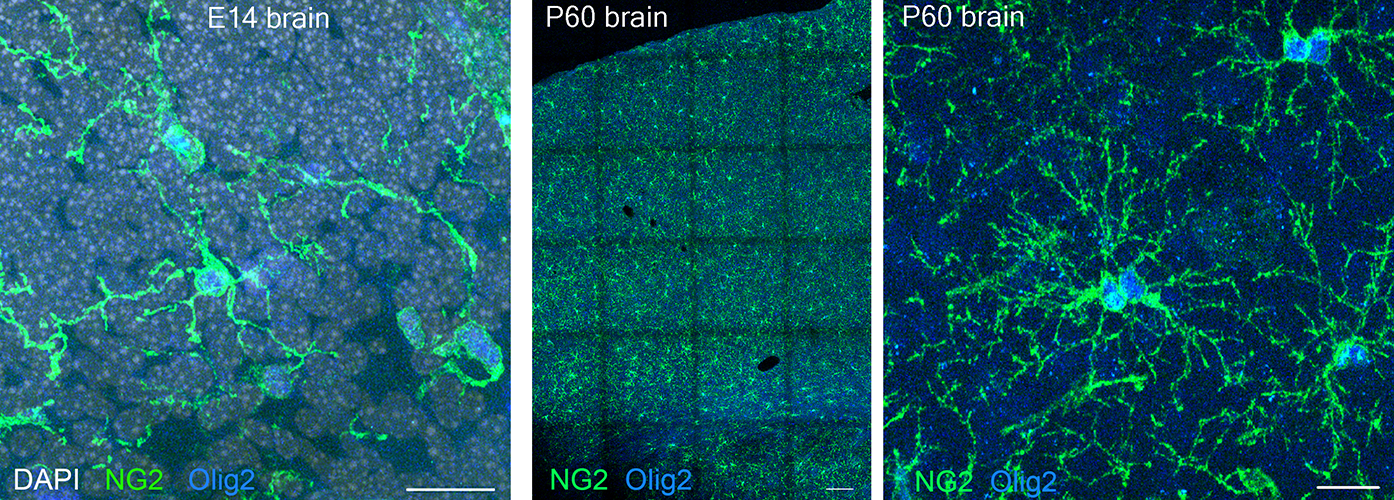 Oligodendrocyte precursors in embryonic and adult mouse brain